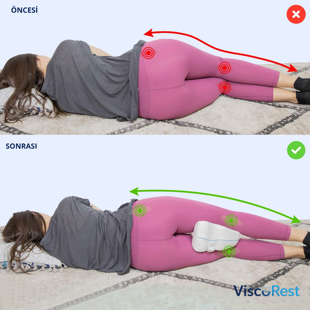 ViscoRest® Ortopedik Bacak Arası Yan Yatış Yastığı