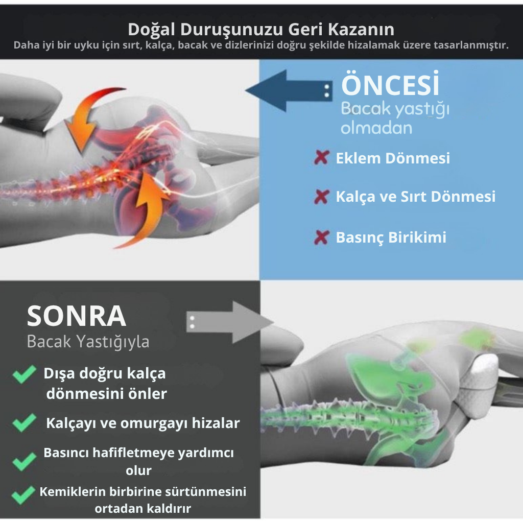 ViscoRest® Ortopedik Bacak Arası Yan Yatış Yastığı